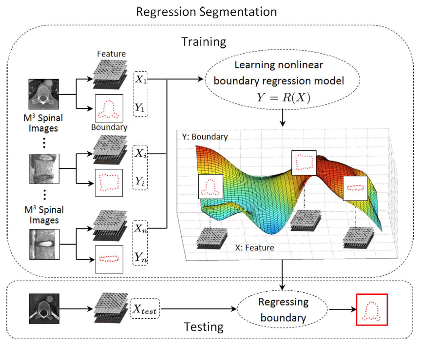 regression segmentation