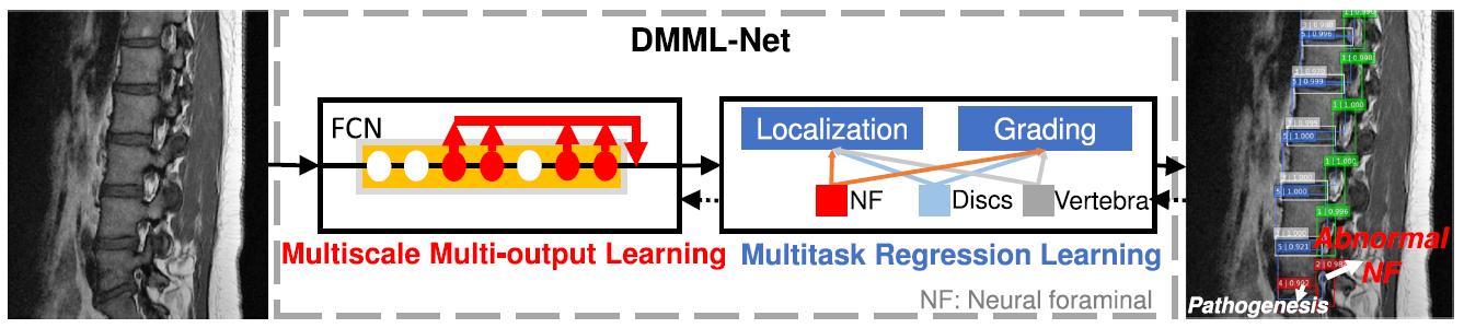 DMML-Net process
