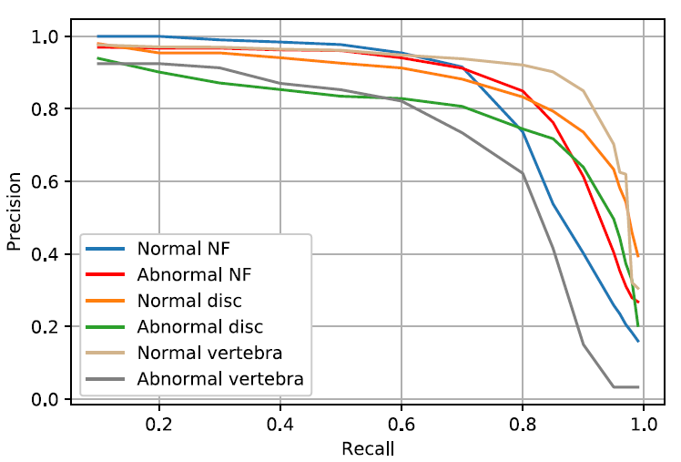 precision-recall curve for the DMML-Net